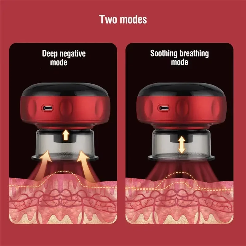 PULSE Electric Cupping Massager — photo 2