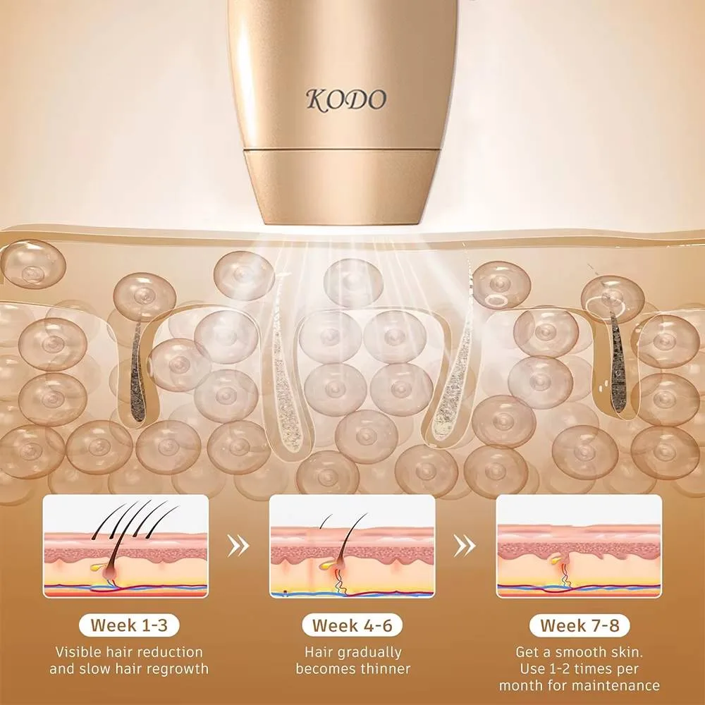 KODO 2026 Ice Laser IPL Hair Removal Device — photo 6
